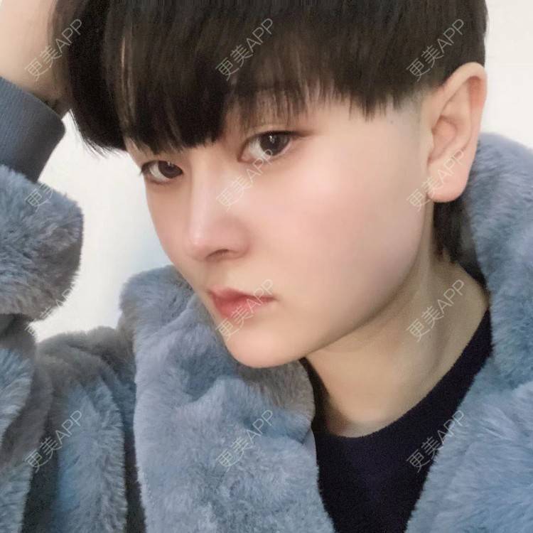 更美 - 全酷开区的下巴经验 | 下巴截骨前移 | 膨体垫下巴 | 硅胶垫下巴 | 宽下巴矫正 | 缩下巴 | 下巴 | 手术缩鼻头 | 自体软骨垫鼻尖 | 胶原蛋白丰下巴 | 人工骨垫下巴 | 鼻小柱延长 | 耳软骨隆鼻