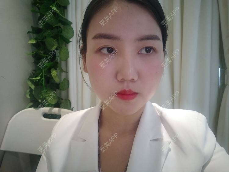 更美 - 陶三岁的硅胶垫下巴经验 | 硅胶垫下巴 | 襄阳