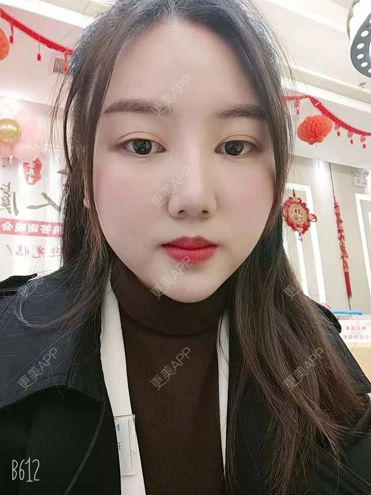 更美 - 陶三岁的硅胶垫下巴经验 | 硅胶垫下巴 | 襄阳