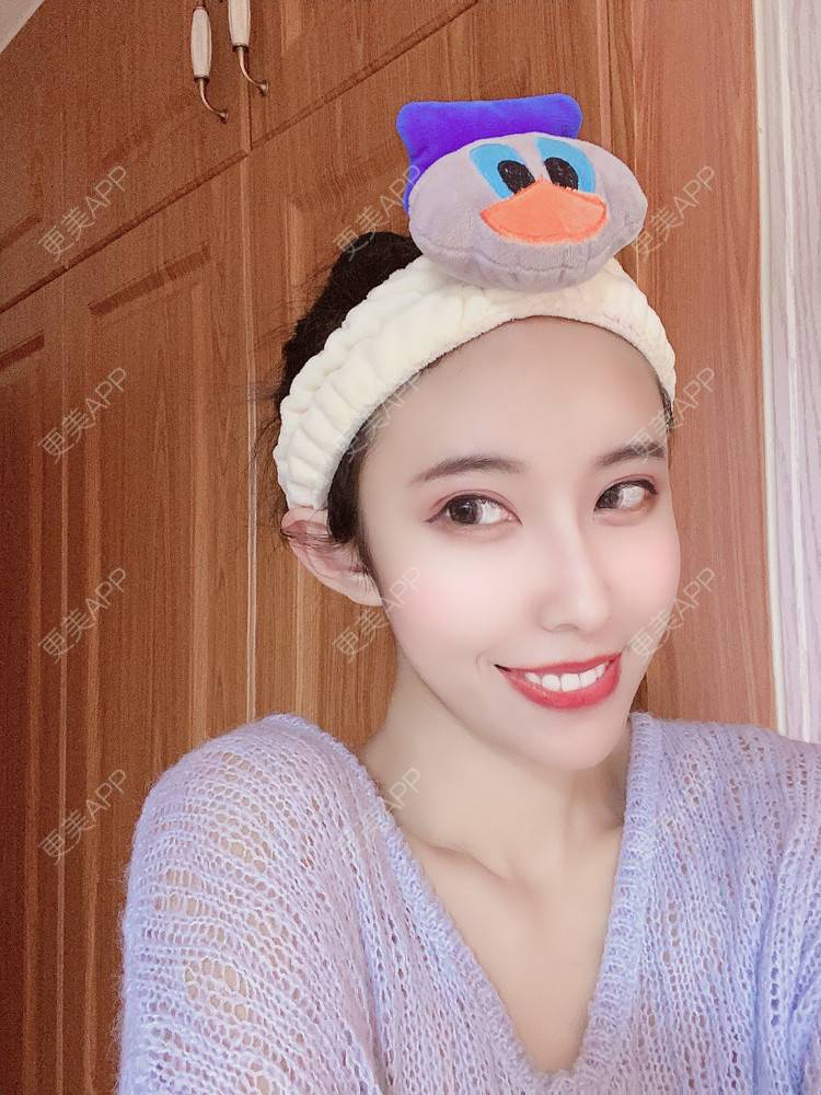更美 - 更美用户sPJ9VN1o87的自体脂肪面部年轻化经验 | 视频日记 | 自体脂肪面部年轻化 | 天津