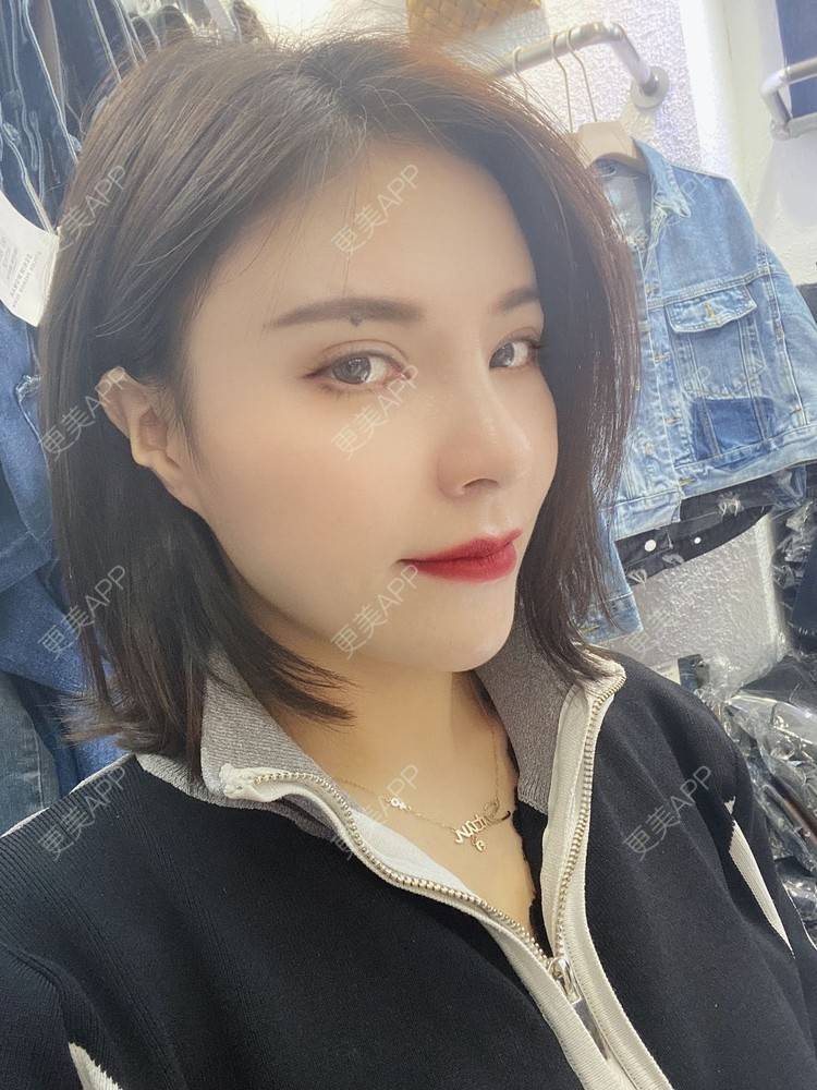 更美 - 更美用户cYoCneHuFl的鼻部多项经验 | 阳江 | 鼻部多项