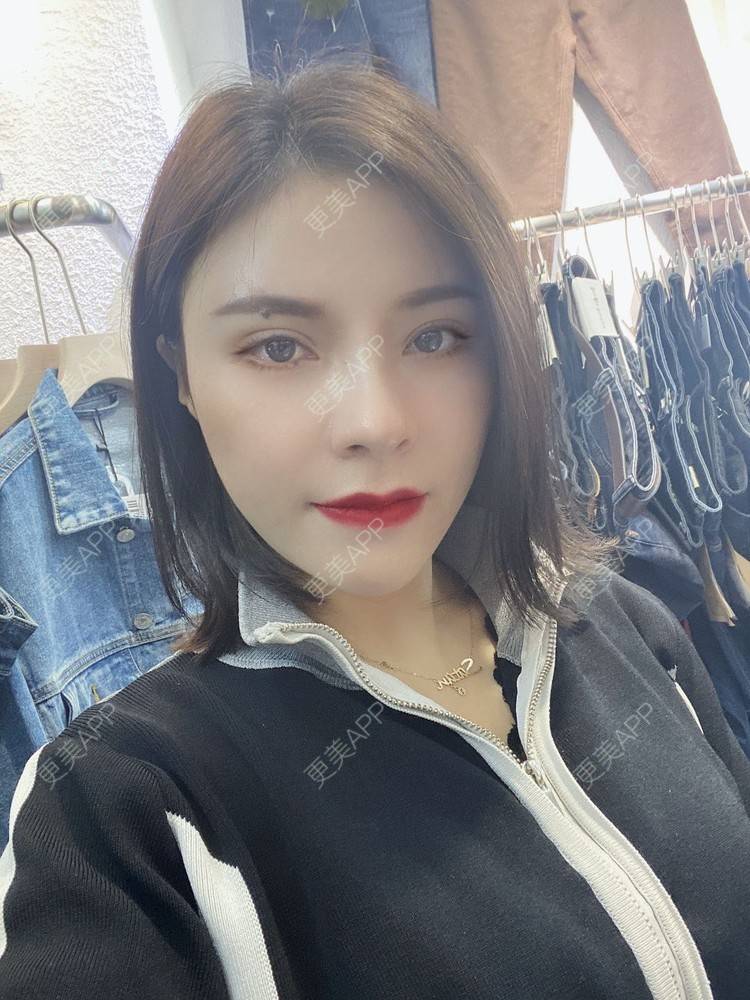 更美 - 更美用户cYoCneHuFl的鼻部多项经验 | 阳江 | 鼻部多项