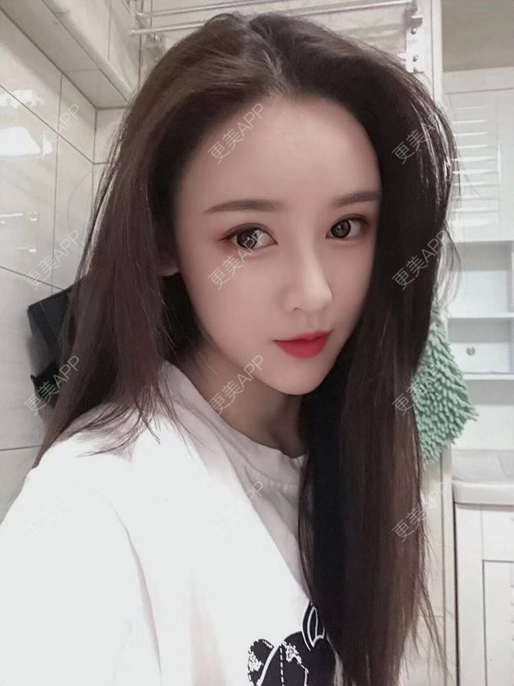 更美 - 萨拉嘿呦枷的埋线除皱经验 | 北京 | 埋线除皱