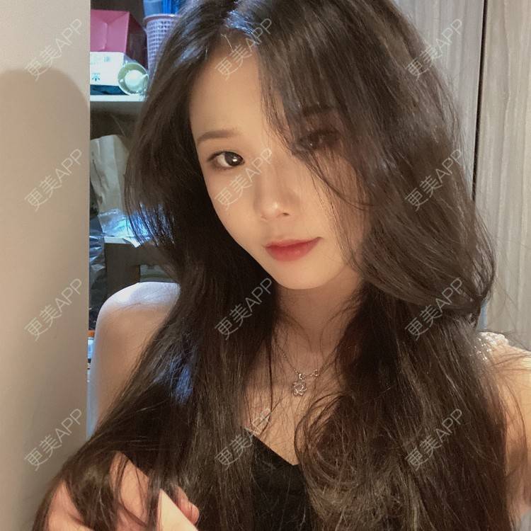 更美 - 天使爱美丽1的下颌角切除经验 | 广州 | 视频日记 | 下颌角切除