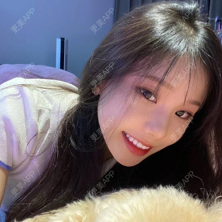 更美 - 天使爱美丽1的下颌角切除经验 | 广州 | 视频日记 | 下颌角切除