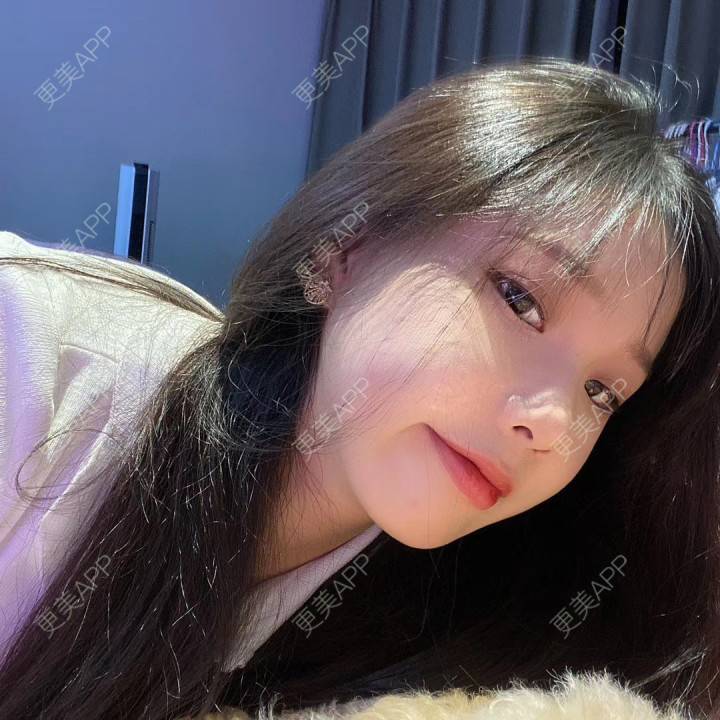更美 - 天使爱美丽1的下颌角切除经验 | 广州 | 视频日记 | 下颌角切除