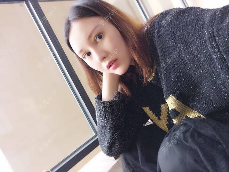 更美 - 天使小妹妹的全切双眼皮经验 | 全切双眼皮 | 重庆