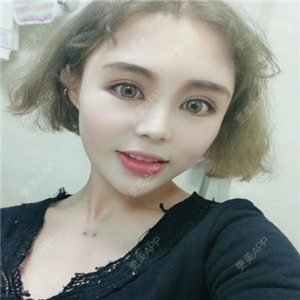 更美 - 更美用户f4z2vULTVO的垫眉弓经验 | 膨体垫眉弓 | 垫眉弓 | 硅胶垫眉弓 | 郑州