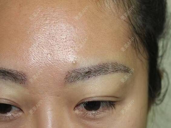 更美 - 更美用户9hJbDy0JWA的植眉经验 | 植眉