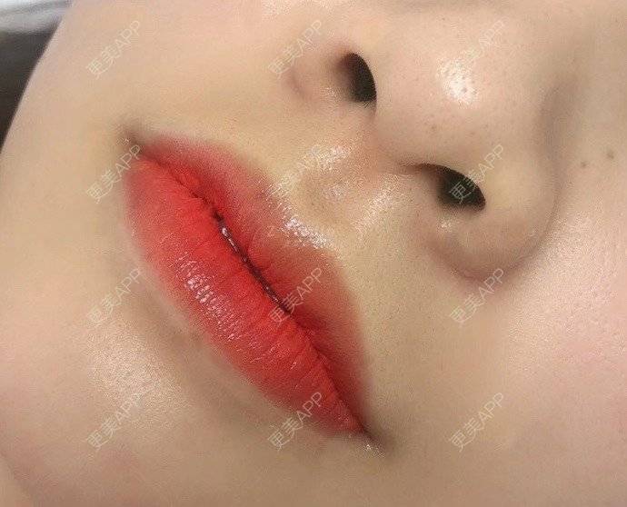 更美 - 更美用户z5eXyqxvdS的半永久纹唇经验 | 半永久纹唇