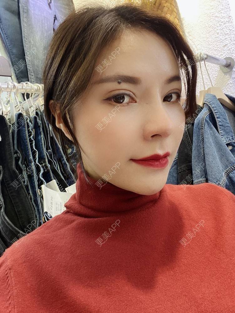 更美 - 更美用户cYoCneHuFl的鼻部多项经验 | 阳江 | 鼻部多项