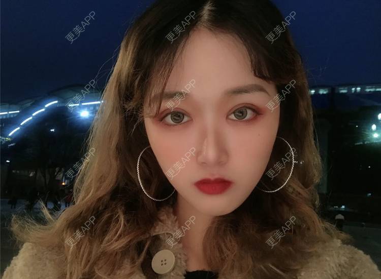 更美 - 张盛波 医生的吸脂瘦脸经验 | 南昌 | 吸脂瘦脸