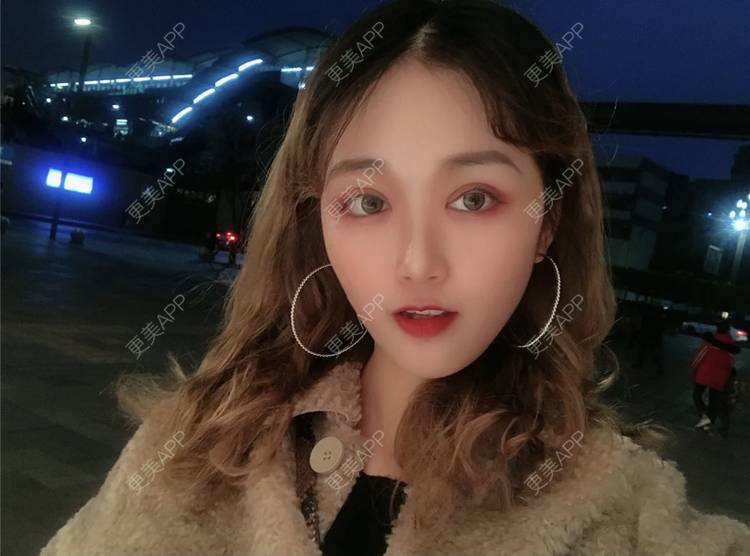 更美 - 张盛波 医生的吸脂瘦脸经验 | 南昌 | 吸脂瘦脸