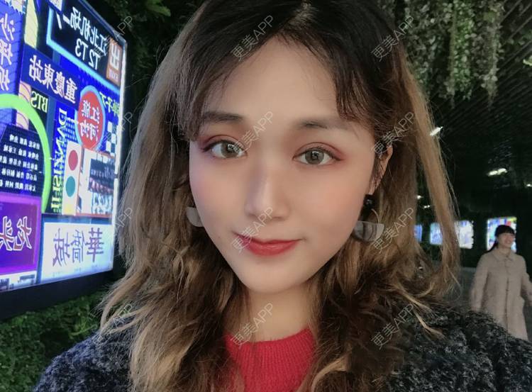 更美 - 张盛波 医生的吸脂瘦脸经验 | 南昌 | 吸脂瘦脸