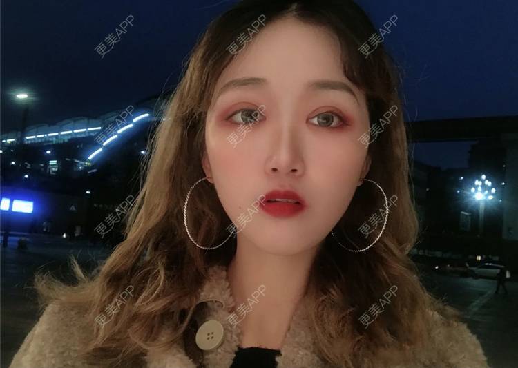 更美 - 张盛波 医生的吸脂瘦脸经验 | 南昌 | 吸脂瘦脸