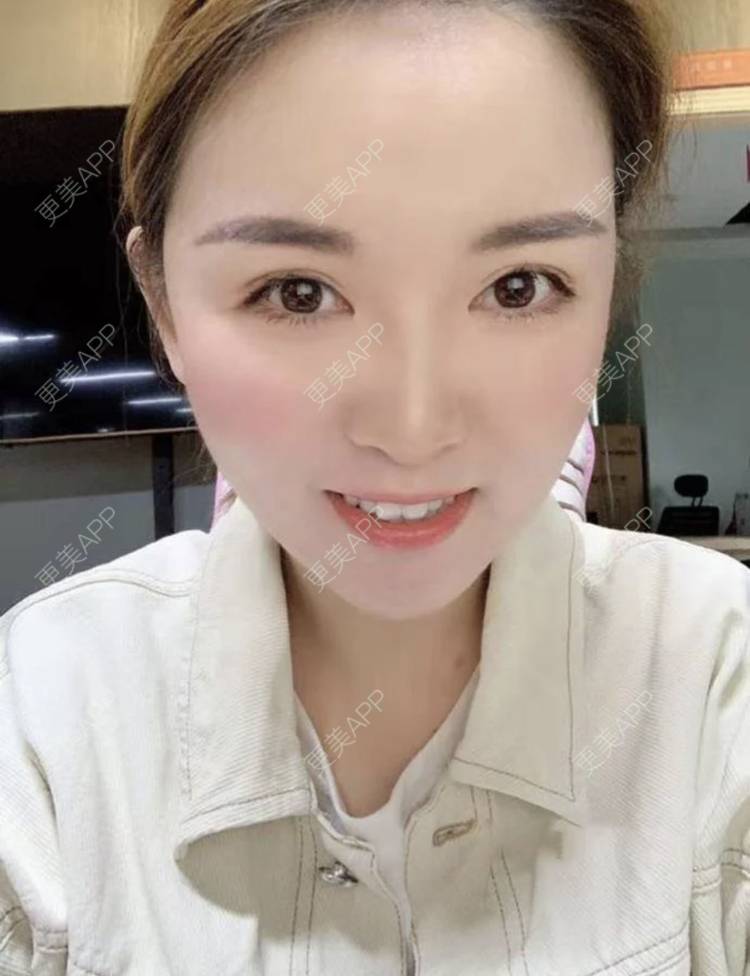 更美 - 刘有魁 医生的吸脂瘦脸经验 | 南昌 | 吸脂瘦脸