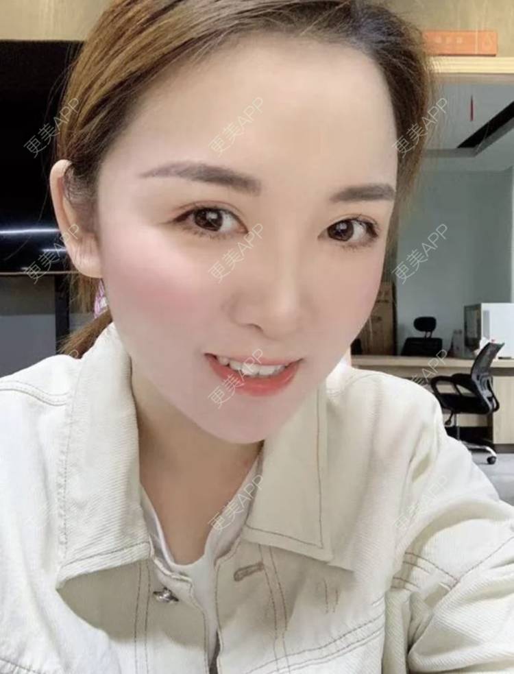 更美 - 刘有魁 医生的吸脂瘦脸经验 | 南昌 | 吸脂瘦脸