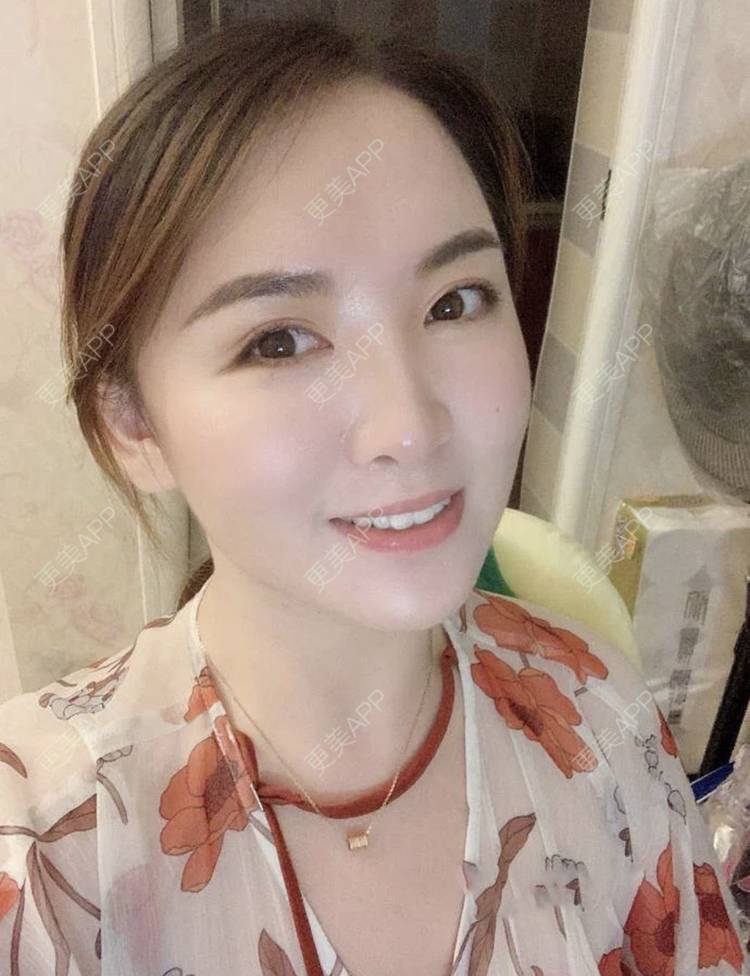 更美 - 刘有魁 医生的吸脂瘦脸经验 | 南昌 | 吸脂瘦脸