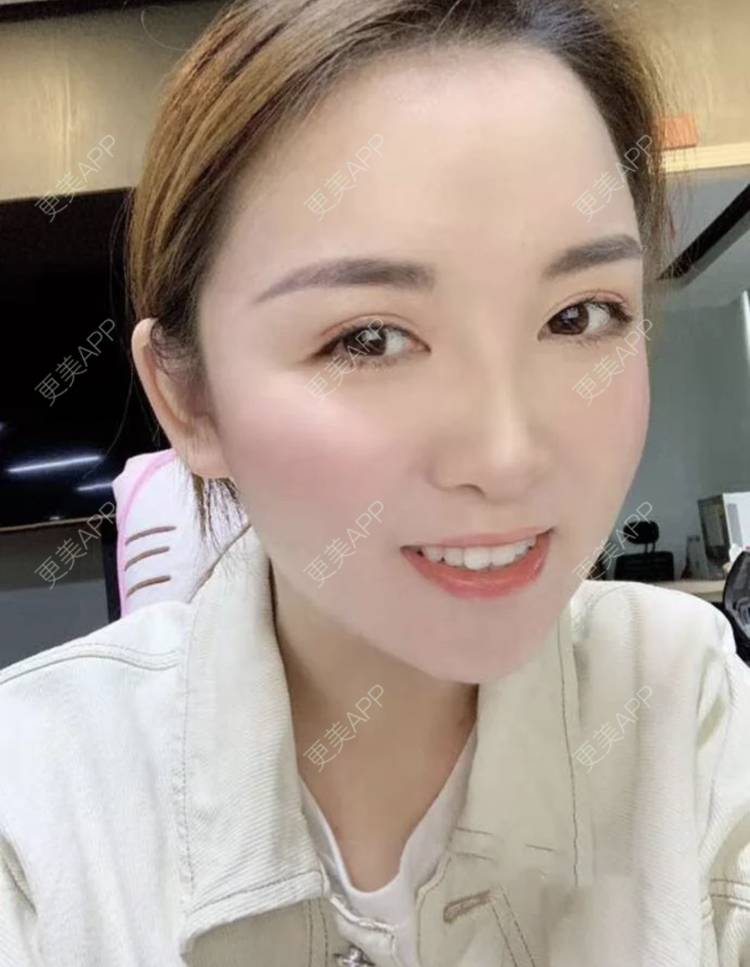 更美 - 刘有魁 医生的吸脂瘦脸经验 | 南昌 | 吸脂瘦脸