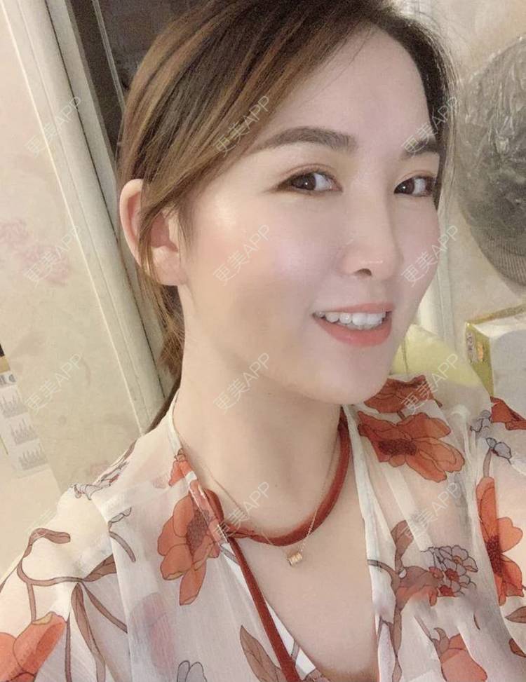 更美 - 刘有魁 医生的吸脂瘦脸经验 | 南昌 | 吸脂瘦脸