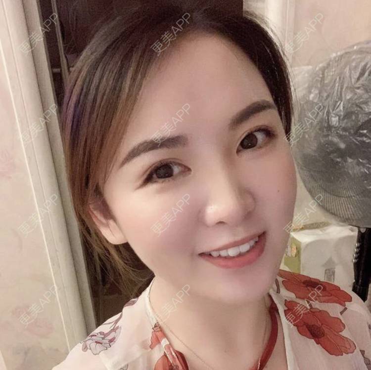 更美 - 刘有魁 医生的吸脂瘦脸经验 | 南昌 | 吸脂瘦脸