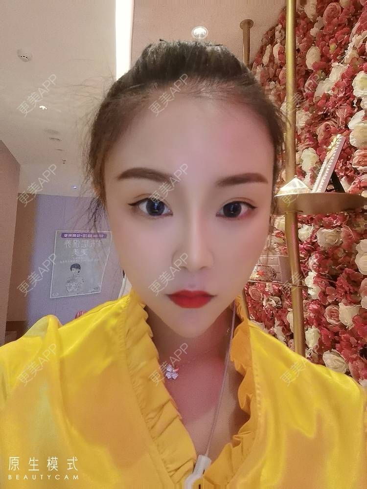更美 - 更美用户wOARiRO1Ls的真皮丰卧蚕经验 | 北京 | 视频日记 | 真皮丰卧蚕