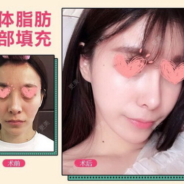 更美用户Kagp03q2ym
