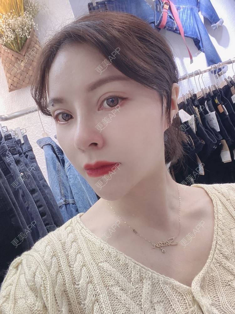 更美 - 更美用户cYoCneHuFl的鼻部多项经验 | 阳江 | 鼻部多项