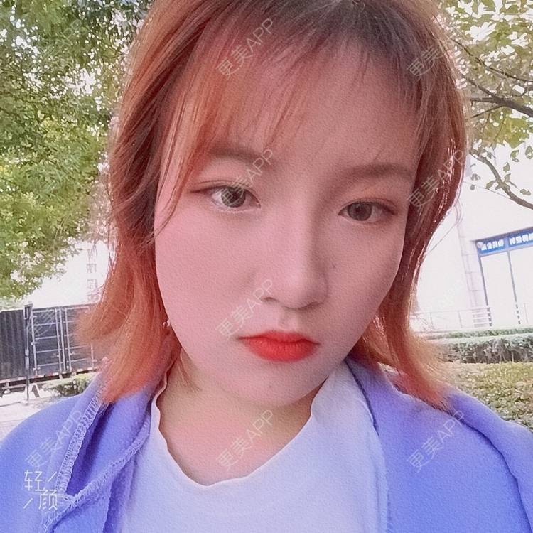 更美 - 更美用户tbs28rKiLZ的定点双眼皮经验 | 定点双眼皮 | 杭州