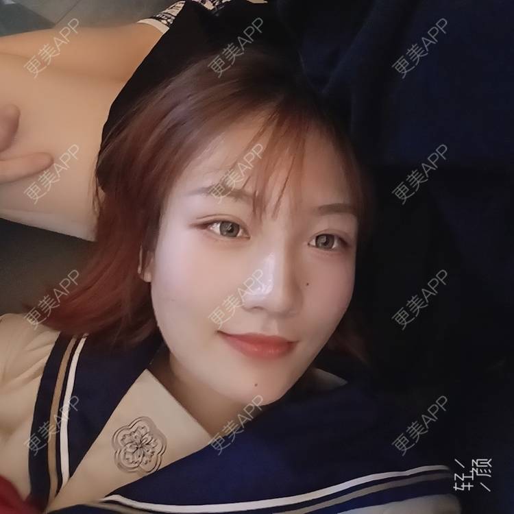 更美 - 更美用户tbs28rKiLZ的定点双眼皮经验 | 定点双眼皮 | 杭州