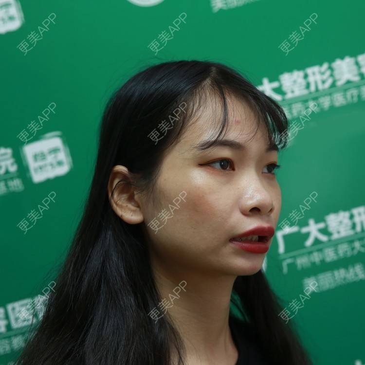 更美 - 萍萍姐呀的凸嘴矫正经验 | 凸嘴矫正 | 广州
