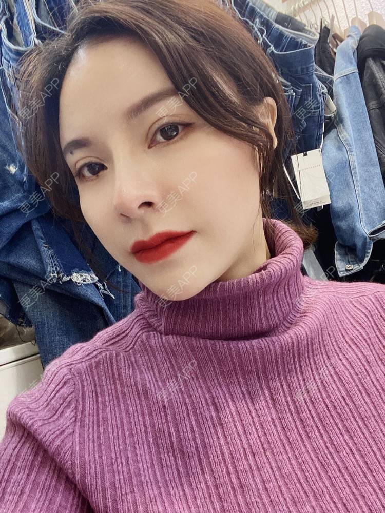 更美 - 更美用户cYoCneHuFl的鼻部多项经验 | 阳江 | 鼻部多项