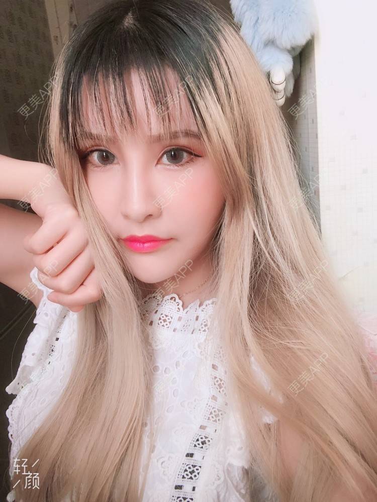 更美 - 阿依古丽💫的全切双眼皮经验 | 视频日记 | 全切双眼皮 | 重庆