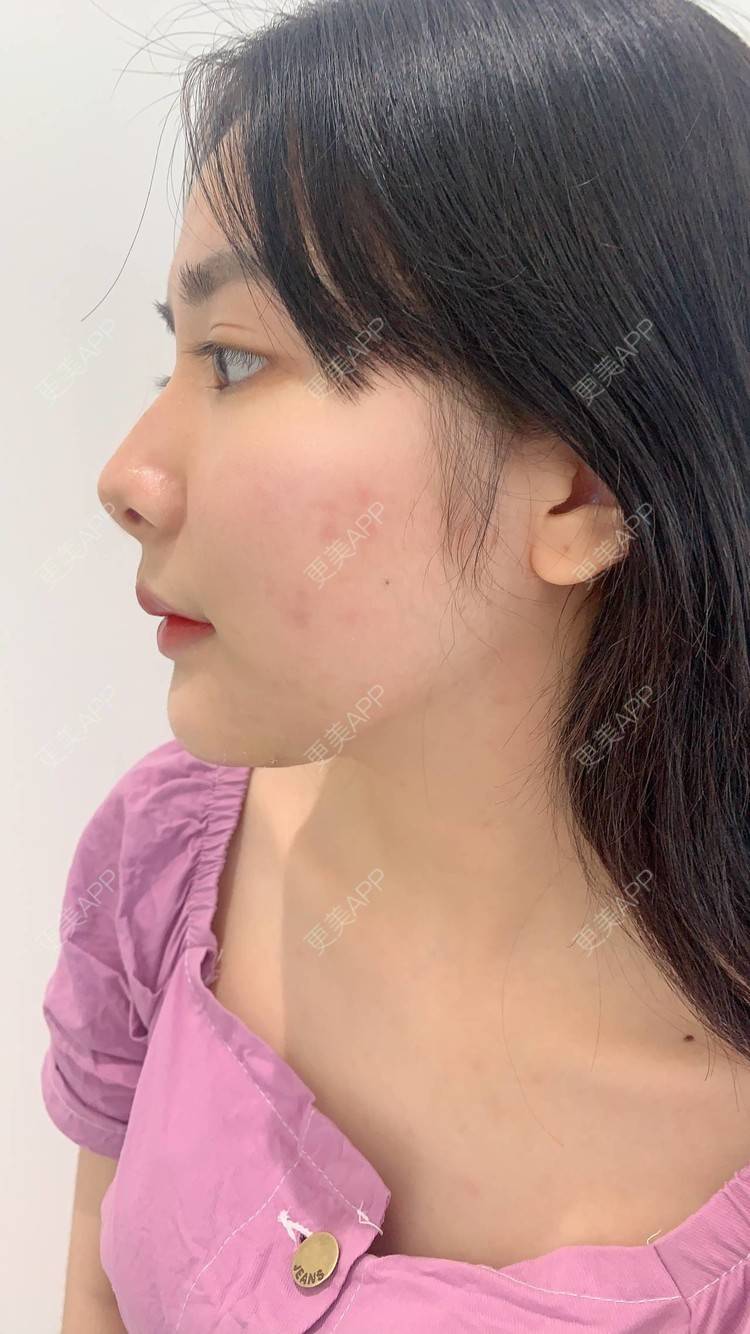 更美用户vvc75tpiod的硅胶垫下巴日记