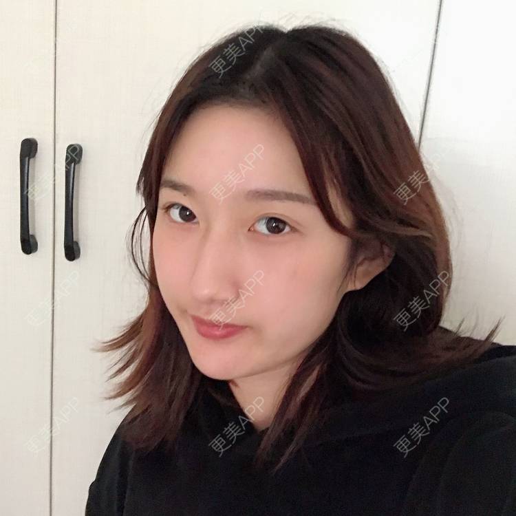 更美 - 撒娇惯犯苯的激光淡疤经验 | 彩光嫩肤 | 皮肤美容 | 激光淡疤 | 成都