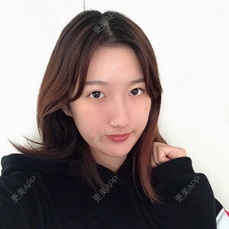 更美 - 撒娇惯犯苯的激光淡疤经验 | 彩光嫩肤 | 皮肤美容 | 激光淡疤 | 成都