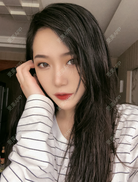 更美 - 小小的人儿@的隆鼻经验 | 隆鼻 | 苏州