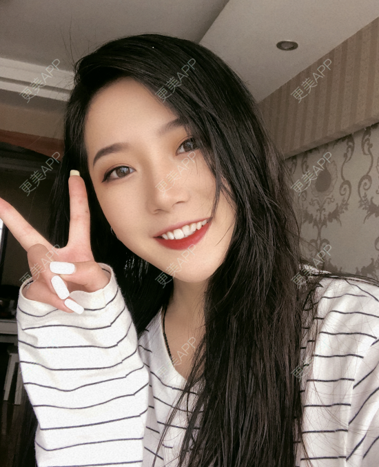 更美 - 小小的人儿@的隆鼻经验 | 隆鼻 | 苏州