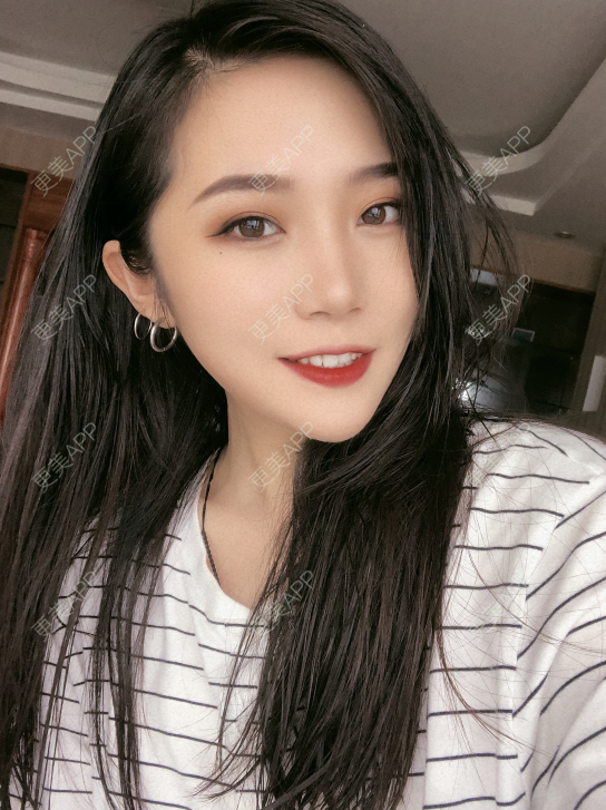 更美 - 小小的人儿@的隆鼻经验 | 隆鼻 | 苏州