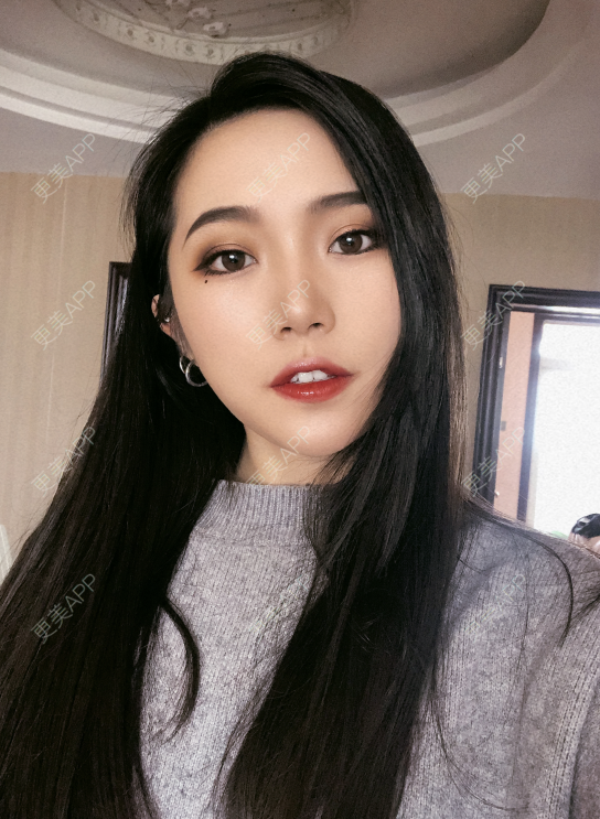 更美 - 小小的人儿@的隆鼻经验 | 隆鼻 | 苏州