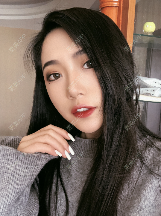 更美 - 小小的人儿@的隆鼻经验 | 隆鼻 | 苏州