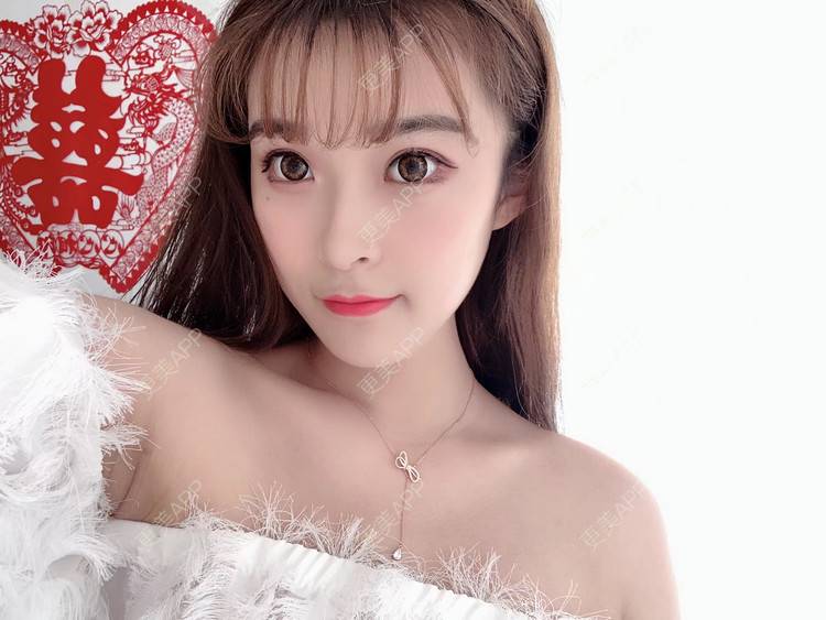 更美 - 甜幂有你的下颌角切除经验 | 广州 | 视频日记 | 下颌角切除