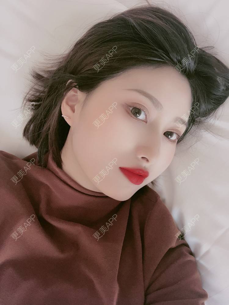 更美 - 更美用户JpxuFzIkAJ的鼻部多项经验 | 广州 | 视频日记 | 鼻部多项
