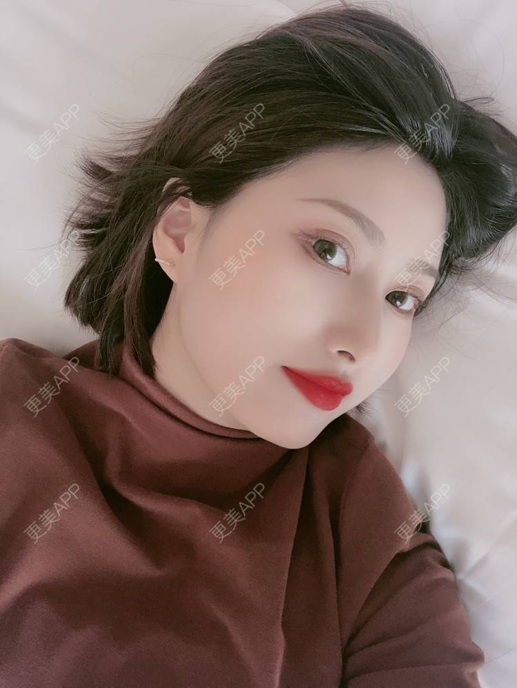 更美 - 更美用户JpxuFzIkAJ的鼻部多项经验 | 广州 | 视频日记 | 鼻部多项