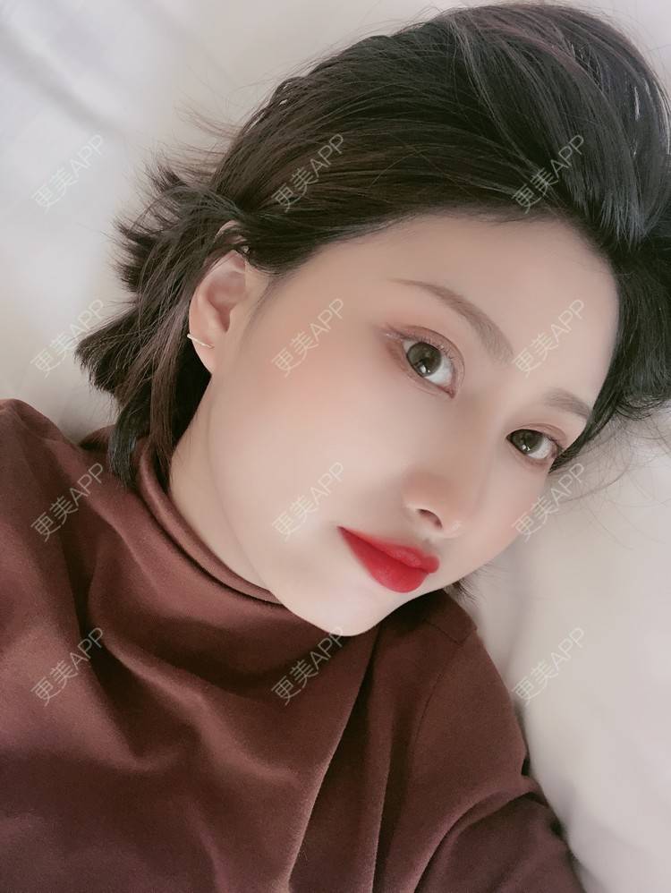 更美 - 更美用户JpxuFzIkAJ的鼻部多项经验 | 广州 | 视频日记 | 鼻部多项