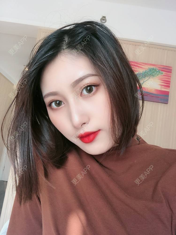 更美 - 更美用户JpxuFzIkAJ的鼻部多项经验 | 广州 | 视频日记 | 鼻部多项