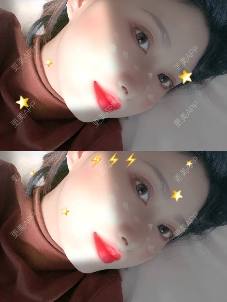更美 - 更美用户JpxuFzIkAJ的鼻部多项经验 | 广州 | 视频日记 | 鼻部多项