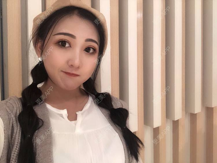 更美 - 更美用户wQDaXLbprp的玻尿酸鼻部经验 | 广州 | 玻尿酸鼻部