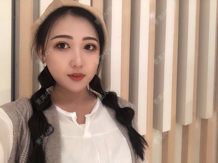更美 - 更美用户wQDaXLbprp的玻尿酸鼻部经验 | 广州 | 玻尿酸鼻部