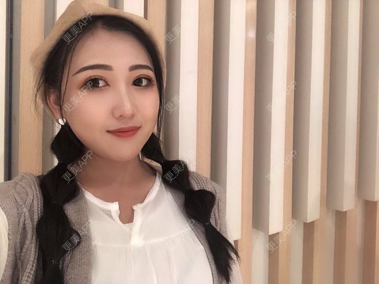 更美 - 更美用户wQDaXLbprp的玻尿酸鼻部经验 | 广州 | 玻尿酸鼻部
